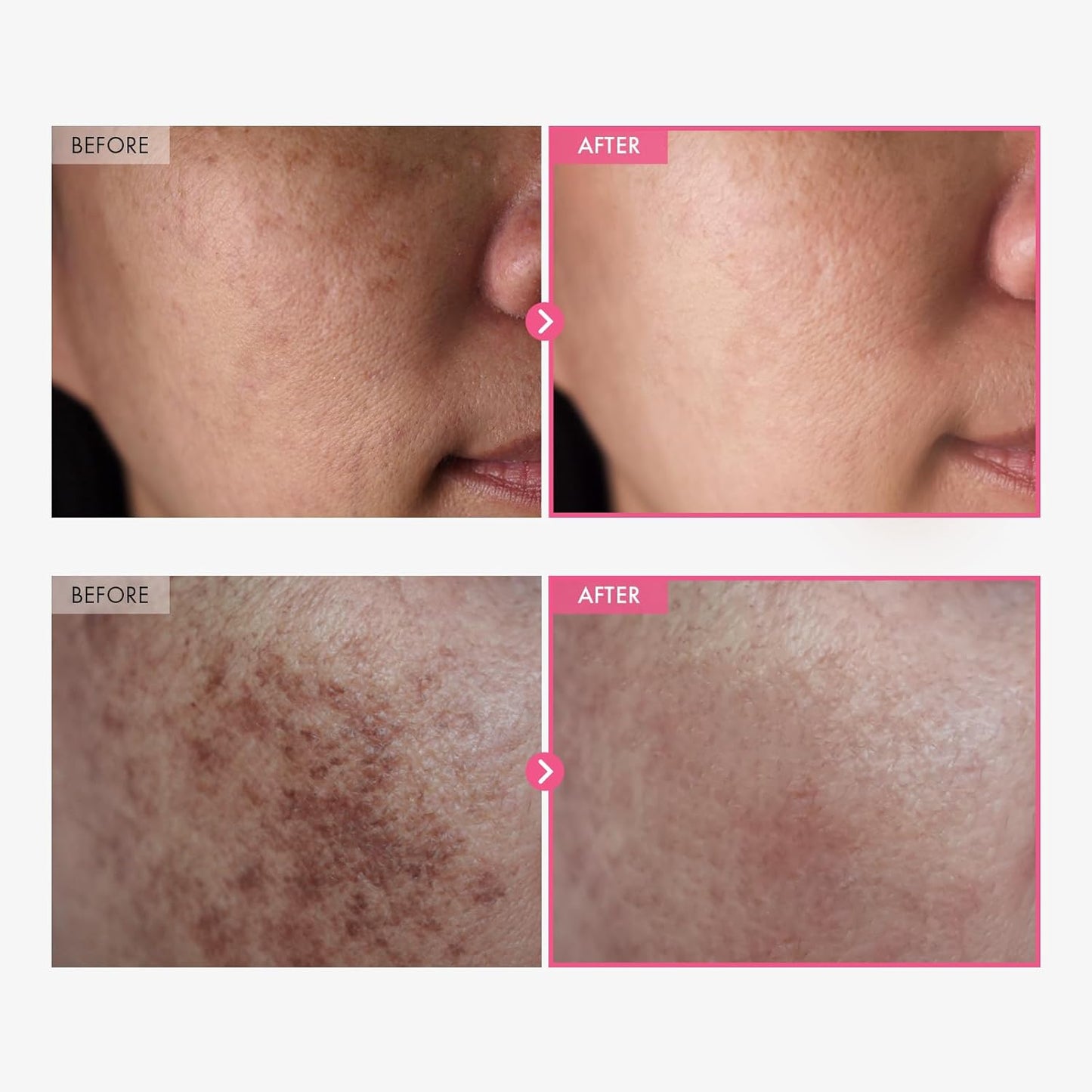 Radiant Skin Renewal Cream™